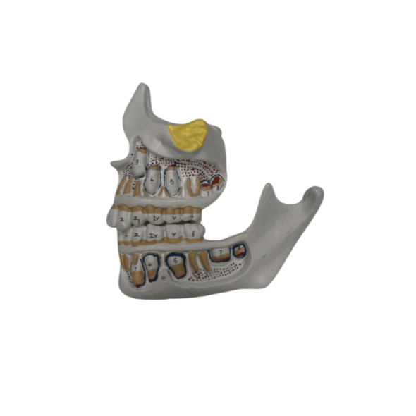 Modelo de Desenvolvimento da Dentição com 4 Peças
