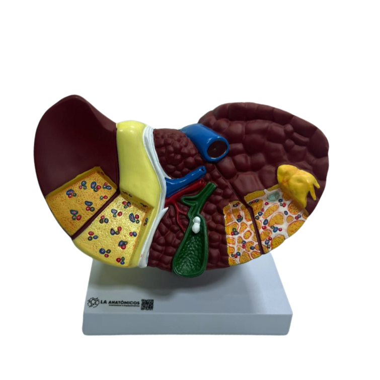 Modelo de Fígado com Patologia
