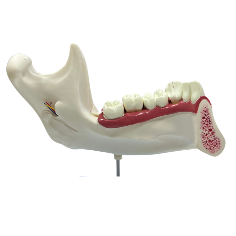Modelo de Anatomia do Dente e Mandíbula Inferior de um Jovem (18 anos), em 6 Partes