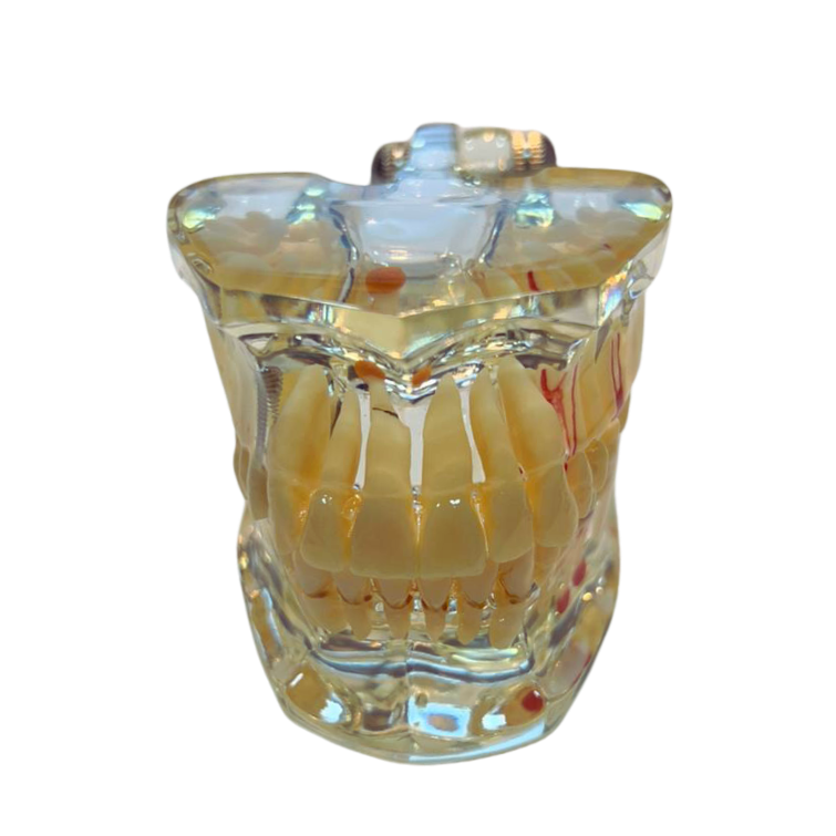 Modelo de Patologia Odontológica Transparente