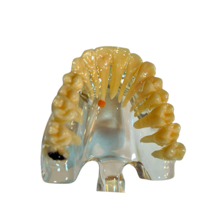 Modelo de Patologia Odontológica Transparente