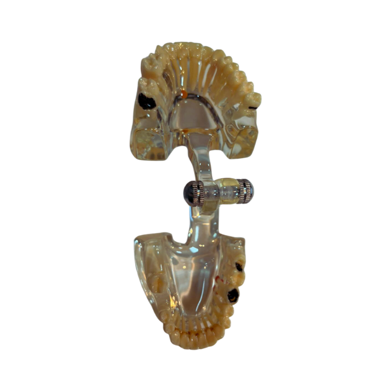 Modelo de Patologia Odontológica Transparente