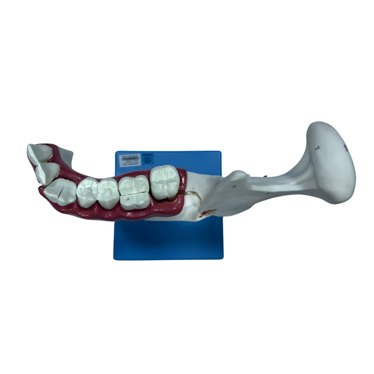 Modelo de Anatomia do Dente e Mandíbula Inferior de um Jovem (18 anos), em 6 Partes