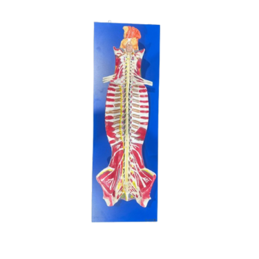 Modelo de Sistema de Medula Espinhal em seu Canal, em Placa